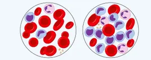 A march to raise awareness of leukaemia